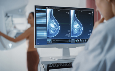 3D Breast Tomosynthesis
