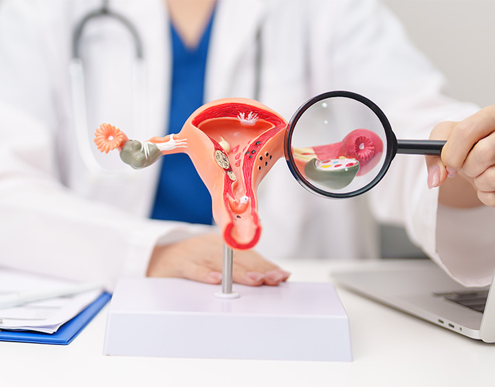 Gynecological Cancer