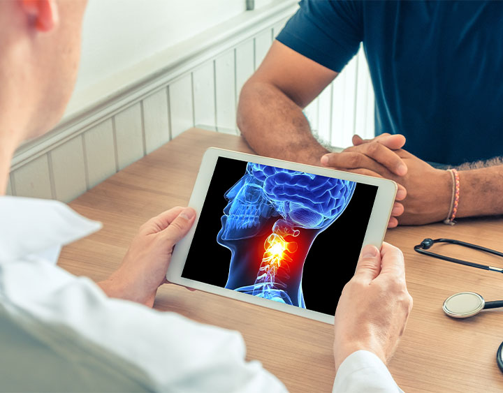Head and Neck Cancer