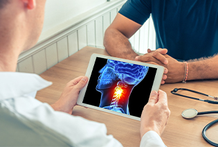 Head and Neck Cancer