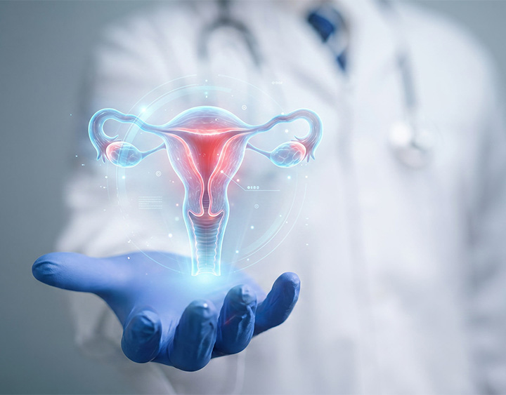 Gynecological Cancer