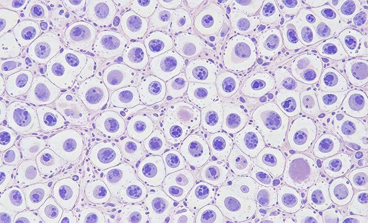 Hematopathology services