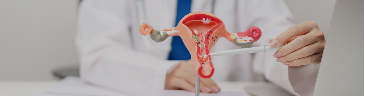 For Endometrial and Ovarian Cancer