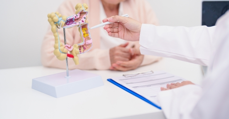Your Screening Journey at Apollo Cancer Centres Colorectal Cancer