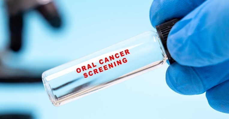 For Oral Cancer