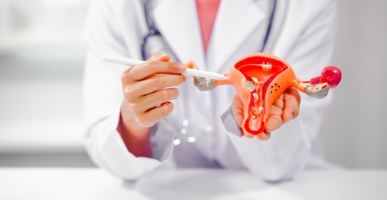 Why Screening Is Important Ovarian Cancer