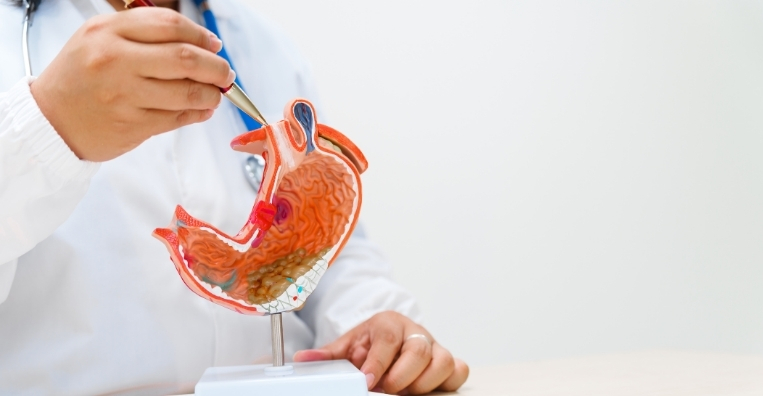 Why Screening Is Important Stomach Cancer