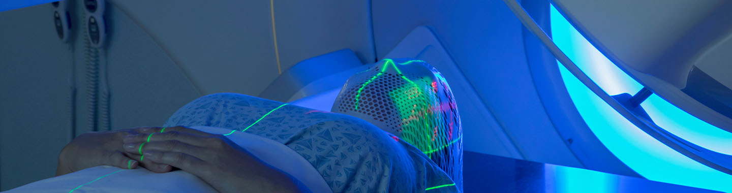 External Beam Radiation Therapy (EBRT)