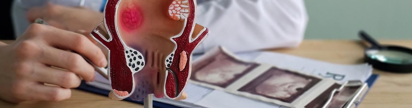 Radioembolisation Therapy