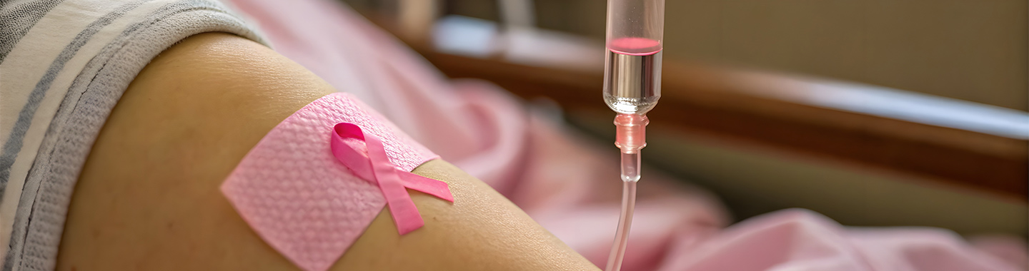 Pressurised Intraperitoneal Aerosol Chemotherapy (PIPAC)
