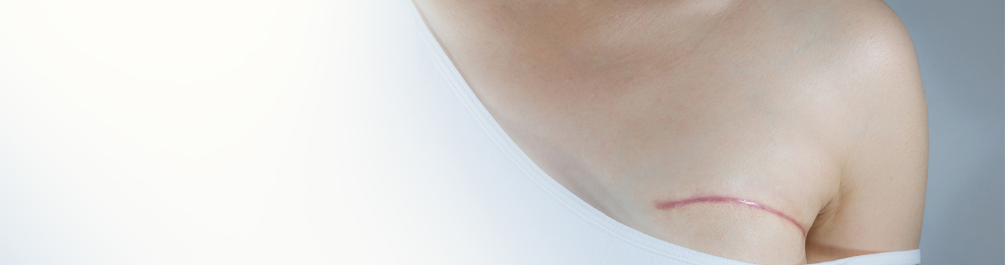 Oncoplastic &amp; Reconstructive Cancer Surgery