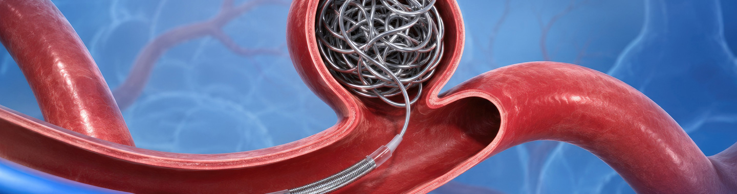Embolisation Therapy