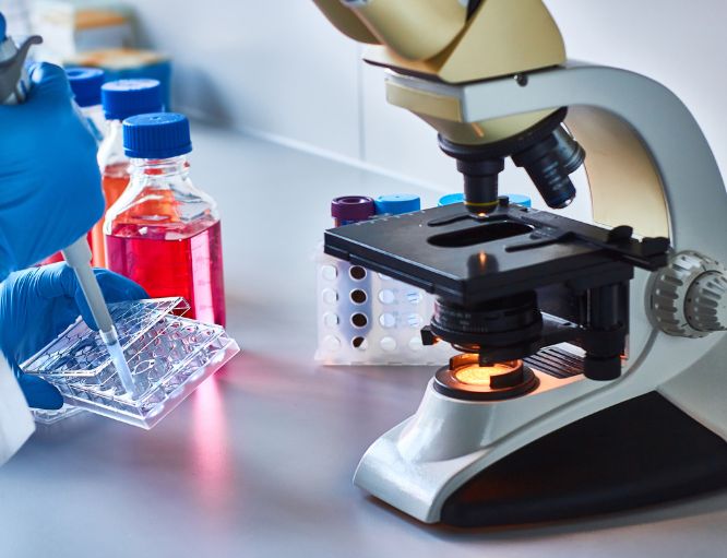 Stem Cell Transplant