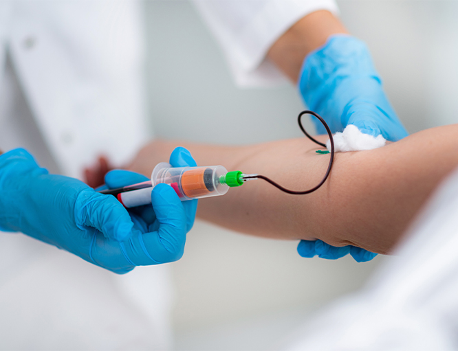CAR T-Cell Therapy