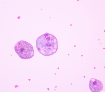 Donor Immune Effect