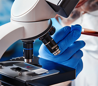 Activation of the Immune System