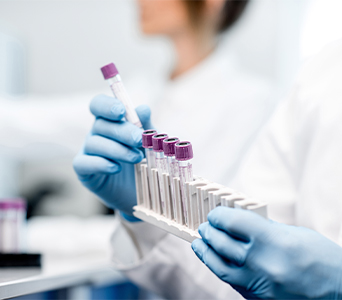 Identification of Actionable Biomarkers