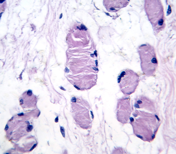 Reduced Tissue Disruption