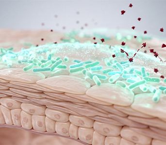 Treatment of Microscopic Residual Disease