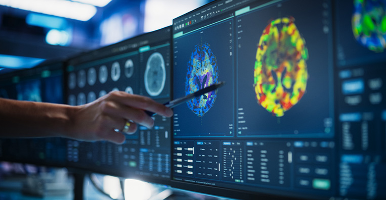 Image-Guided Radiation Therapy
