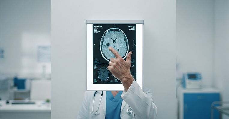 Stereotactic Radiosurgery