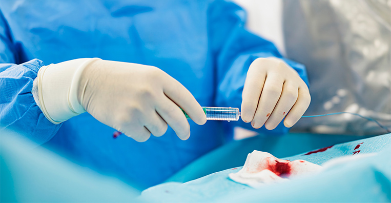 Embolisation Therapy