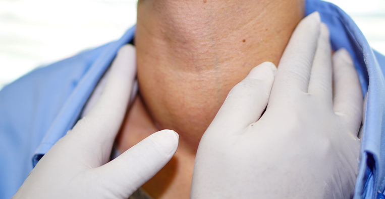 Radioiodine Therapy
