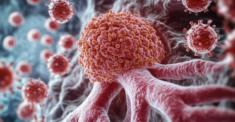 Theranostics