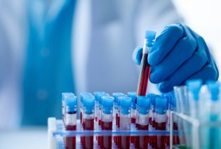 Myelodysplastic syndromes