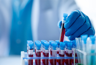 Selected Blood Cancers