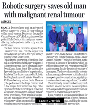 Committed to Innovate: Honoured to be Eastern India’s First Robotic Radical Nephrectomy with IVC Thrombectomy for renal tumour news img - 4