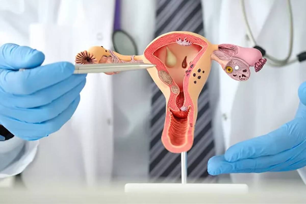 Why gynaecological cancers are rising among young Indian women