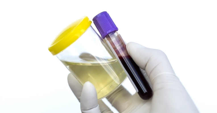 Clinical Chemistry Advantages