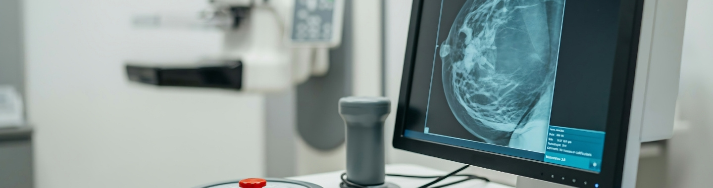 Digital Breast Tomosynthesis