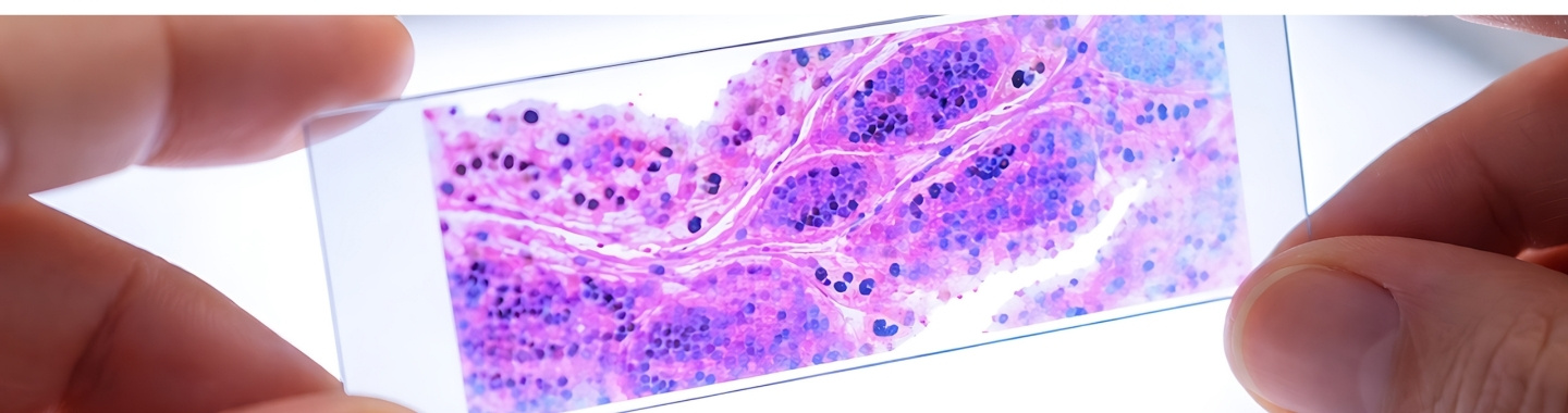 Histopathology 