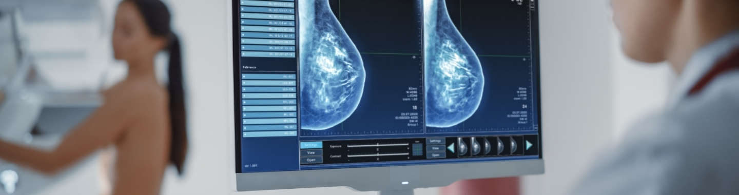 Mammography