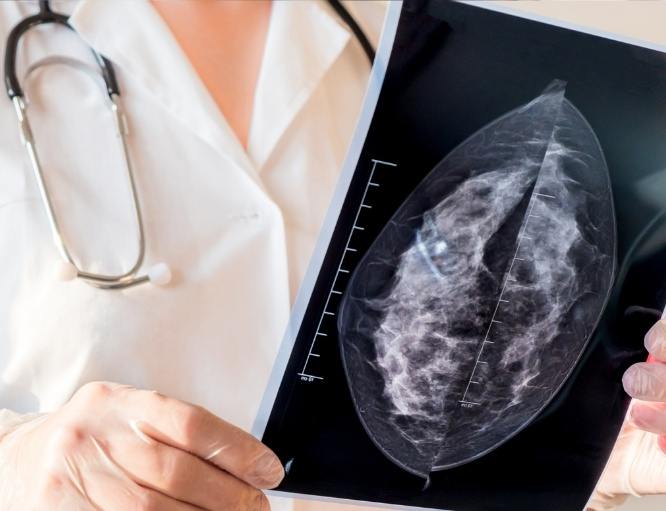 Contrast-Enhanced Mammography (CEM)