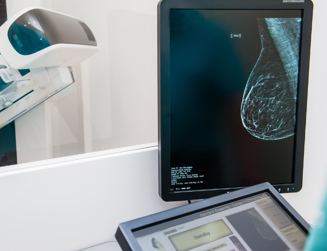 Digital Breast Tomosynthesis
