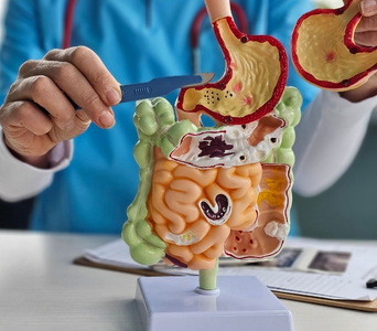 Investigating Unexplained Bleeding
