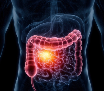 Examining Gastrointestinal Tumours
