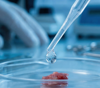 Biopsy Samples
