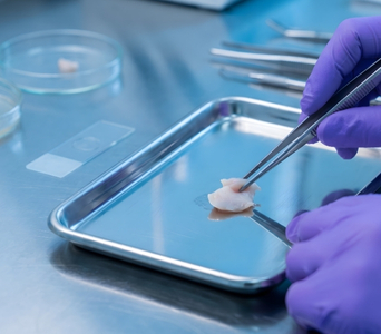Surgical Specimens