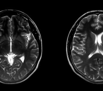 Detecting and Characterising Abnormalities