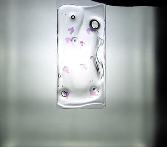 Surgical Specimens