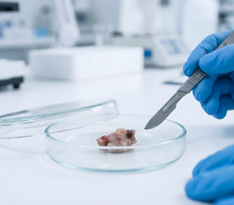 Tumour Samples