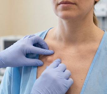 Lymph Nodes