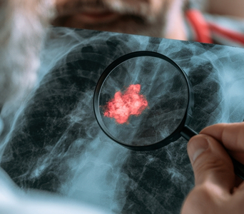 Investigating Chest Abnormalities
