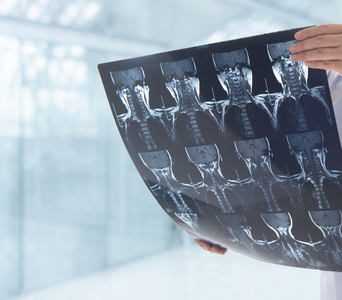 Detecting &amp; Evaluating Abnormalities