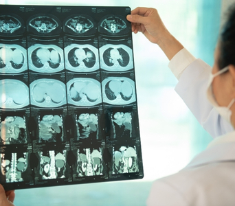 Monitoring Treatment Response