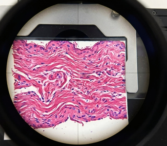 Tissue Samples